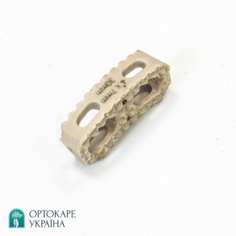 Боковий грудний міжхребцевий кейдж PEEK Ø4 "ORTHO CARE"